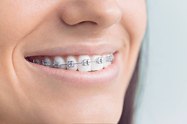 Full Mouth Reconstruction in Kensington, MD